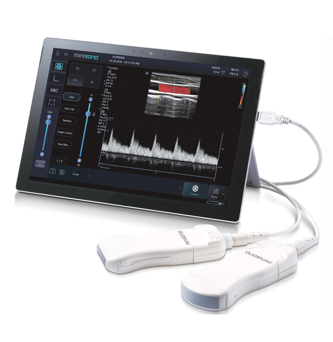 Minisono El Ec Grafo Ultraport Til Medical Scan