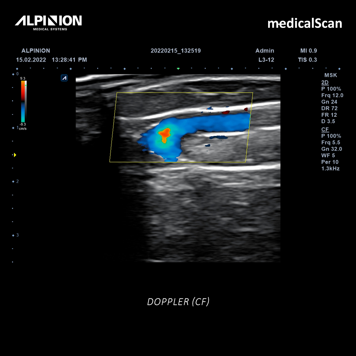 Ecografía Doppler Medical Scan