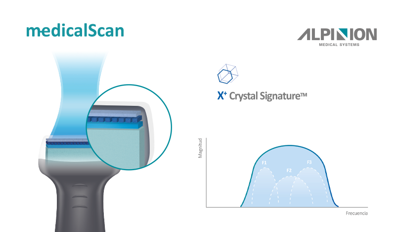 Imagen descriptiva de transductor y esquema sencillo de tecnologia X Crystal Signature de ALPINION